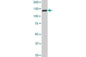 FLJ39155 polyclonal antibody (A01), Lot # 051024JC01 Western Blot analysis of FLJ39155 expression in NIH/3T3 .