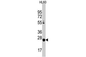 Western blot analysis of LIN28B polyclonal antibody  in HL-60 cell line lysates (35 ug/lane). (LIN28B anticorps  (C-Term))