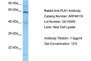 Western Blotting (WB) image for anti-Polo-Like Kinase 1 (PLK1) (N-Term) antibody (ABIN2782495) (PLK1 anticorps  (N-Term))
