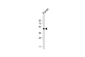 Anti-MYLIP Antibody (Center) at 1:2000 dilution + Rat brain lysate Lysates/proteins at 20 μg per lane.