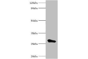 Western blot All lanes: MED6 antibody at 8 μg/mL + Jurkat whole cell lysate Secondary Goat polyclonal to rabbit IgG at 1/10000 dilution Predicted band size: 29, 30, 21 kDa Observed band size: 29 kDa (MED6 anticorps  (AA 27-246))