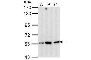 WB Image Sample (30 ug of whole cell lysate) A: Hep G2 , B: Molt-4 , C: Raji 7. (DARS anticorps)