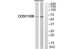 Western blot analysis of extracts from HuvEc cells and COLO cells, using CCDC102B antibody. (CCDC102B anticorps  (Internal Region))