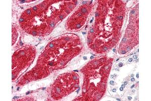 Anti-DPEP1 antibody IHC of human kidney. (DPEP1 anticorps  (N-Term))