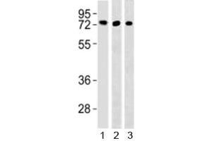 Western blot testing of TFE3 antibody and 1) HepG2, 293 and 3) mouse lung lysate