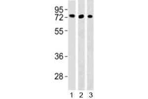 Western blot testing of TFE3 antibody and 1) HepG2, 293 and 3) mouse lung lysate (TFE3 anticorps  (AA 1-30))