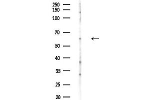 anti-Coronin, Actin Binding Protein, 1C (CORO1C) (C-Term) antibody