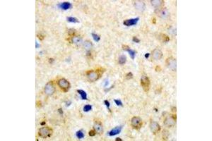 Immunohistochemical analysis of NPY5R staining in human brain formalin fixed paraffin embedded tissue section.