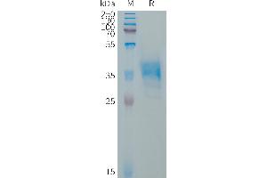 Human Protein, hFc Tag on SDS-PAGE under reducing condition.