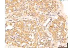 IHC analysis of EIF4B using anti-EIF4B antibody (ABIN7599496).