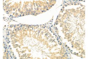 ABIN6261870 and ABIN6266696 at 1/100 staining Rat testis tissue by IHC-P. (GAK anticorps  (N-Term))