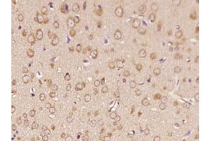 Paraformaldehyde-fixed, paraffin embedded rat brain, Antigen retrieval by boiling in sodium citrate buffer (pH6.
