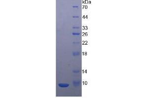 Image no. 2 for Chemokine (C-X-C Motif) Ligand 2 (CXCL2) (AA 28-100) protein (His tag) (ABIN1980967)