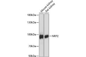 Western blot analysis of extracts of various cell lines, using NRP2 antibody (ABIN6128378, ABIN6144863, ABIN6144864 and ABIN6216499) at 1:3000 dilution. (NRP2 anticorps  (AA 443-740))