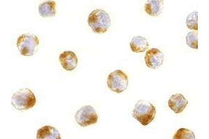 Immunocytochemical staining of MCF7 cells using AP30088PU-N ATF6 antibody at 10 μg/ml.