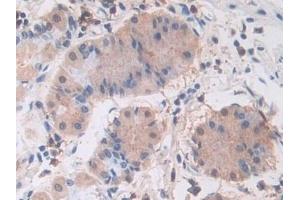 Detection of PIK3Cb in Human Stomach Tissue using Polyclonal Antibody to Phosphoinositide-3-Kinase Catalytic Beta Polypeptide (PIK3Cb)