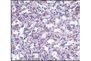 Immunohistochemistry of STIM2 in human spleen tissue with this product at 2.