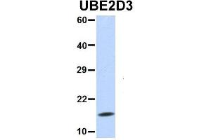 Host:  Rabbit  Target Name:  UBE2D3  Sample Type:  Human Fetal Lung  Antibody Dilution:  1.