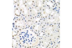 Immunohistochemistry of paraffin-embedded mouse kidney using THOC1 antibody. (THOC1 anticorps  (AA 428-657))