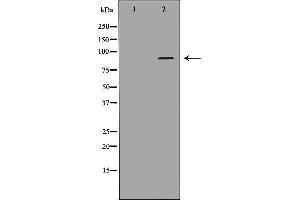 Western blot analysis of extracts of hela cell line, using ADAMTS4 antibody,the lane on the left is blocked by antigen peptide. (ADAMTS4 anticorps  (Internal Region))