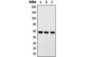 Western blot analysis of OXSR1 expression in HeLa (A), SP2/0 (B), PC12 (C) whole cell lysates.