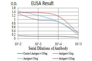 Black line: Control Antigen (100 ng), Purple line: Antigen(10 ng), Blue line: Antigen (50 ng), Red line: Antigen (100 ng),