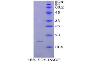 SDS-PAGE analysis of Rat CD72 Protein.