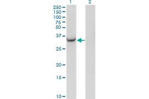 Western Blot analysis of AKR1C2 expression in transfected 293T cell line by AKR1C2 monoclonal antibody (M03A), clone 3C11. (AKR1C2 anticorps  (AA 224-323))
