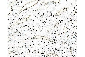 IHC analysis of splicing factor 1 using anti-splicing factor 1 antibody (ABIN7600194). (Splicing Factor 1 anticorps  (AA 160-266))
