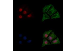 ABIN6255153 and ABIN6267596 staining HepG2 cells(30 min of 4uM Forskolin treatment) by IF/ICC.