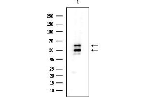 Western blot analysis of lysates from Mouse liver, using Cytokeratin 16 Mouse Monoclonal Antibody at 1/1000 dilution.