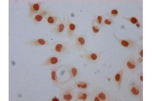 anti-H1 Histone Family, Member 0 (H1F0) (meLys101) antibody