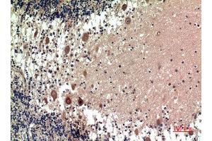 Immunohistochemical analysis of paraffin-embedded human-brain, antibody was diluted at 1:100 (5HT1D anticorps  (Internal Region))