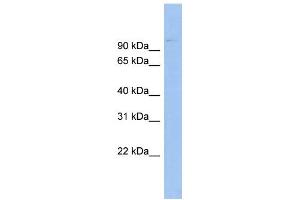 WB Suggested Anti-ABCB6 Antibody Titration:  0. (ABCB6 anticorps  (Middle Region))