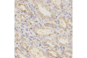 Immunohistochemistry of paraffin-embedded human kidney using GGA2 Antibody.