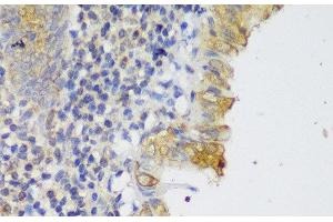 Immunohistochemistry of paraffin-embedded Human appendix using GCC2 Polyclonal Antibody at dilution of 1:150 (40x lens).