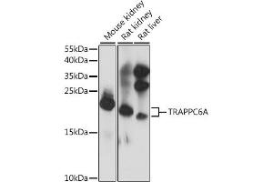 Western blot analysis of extracts of various cell lines, using TRA antibody (ABIN7270871) at 1:1000 dilution. (TRAPPC6A anticorps  (AA 1-173))