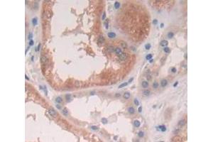Used in DAB staining on fromalin fixed paraffin- embedded Kidney tissue
