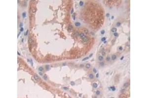 Used in DAB staining on fromalin fixed paraffin- embedded Kidney tissue (SRI anticorps  (AA 29-169))