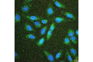 IF analysis of Hexokinase 1/HK1 using anti-Hexokinase 1/HK1 antibody (ABIN7600260). (Hexokinase 1 anticorps  (AA 17-323))