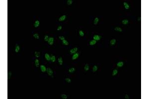 Immunofluorescence staining of Hela cells with ABIN7139626 at 1:25, counter-stained with DAPI.