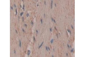 Used in DAB staining on fromalin fixed paraffin- embedded skeletal muscle tissue (UNG anticorps  (AA 1-313))