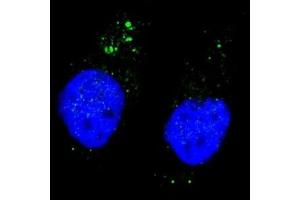 Fluorescent image of Chloroquine treated U251 cells stained with phospho-ULK1 antibody at 1:200.