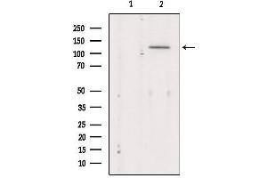 Western blot analysis of extracts from Mouse Myeloma cell, using MaxiK alpha Antibody. (KCNMA1 anticorps  (Internal Region))