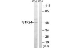Western blot analysis of extracts from COLO cells, using STK24 Antibody. (STK24 anticorps  (AA 319-368))