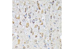 Immunohistochemistry of paraffin-embedded mouse spinal cord using LysRS/KARS Rabbit mAb (ABIN7268350) at dilution of 1:100 (40x lens). (KARS anticorps)