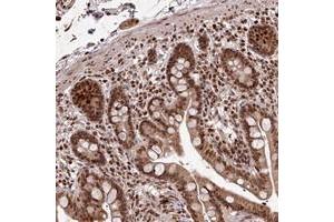 Immunohistochemical staining of human colon with KIAA1128 polyclonal antibody  shows strong nuclear and cytoplasmic positivity in glandular cells. (FAM190B anticorps)