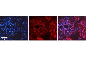 Rabbit Anti-MYH1 Antibody   Formalin Fixed Paraffin Embedded Tissue: Human Testis Tissue Observed Staining: Cytoplasm Primary Antibody Concentration: 1:100 Other Working Concentrations: N/A Secondary Antibody: Donkey anti-Rabbit-Cy3 Secondary Antibody Concentration: 1:200 Magnification: 20X Exposure Time: 0.