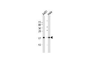 All lanes : Anti-IA Antibody (N-term) at 1:1000 dilution Lane 1: A431 whole cell lysate Lane 2: Hela whole cell lysate Lysates/proteins at 20 μg per lane. (PPIA anticorps  (N-Term))