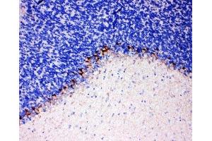 anti-GABA Transporter 1 (GAT1) (C-Term) antibody